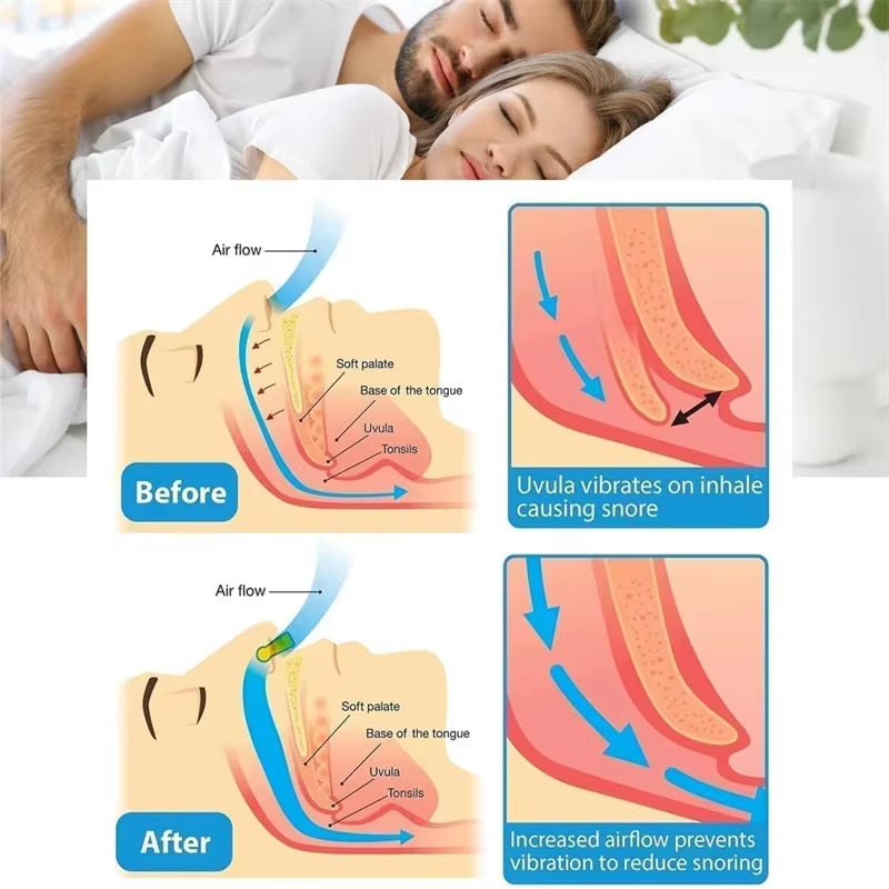 Silicone Magnetic anti Snore Stop Snoring Nose Clip Sleep Tray Sleeping Aid Apnea Guard Night Device with Case Nose Clip Men'S