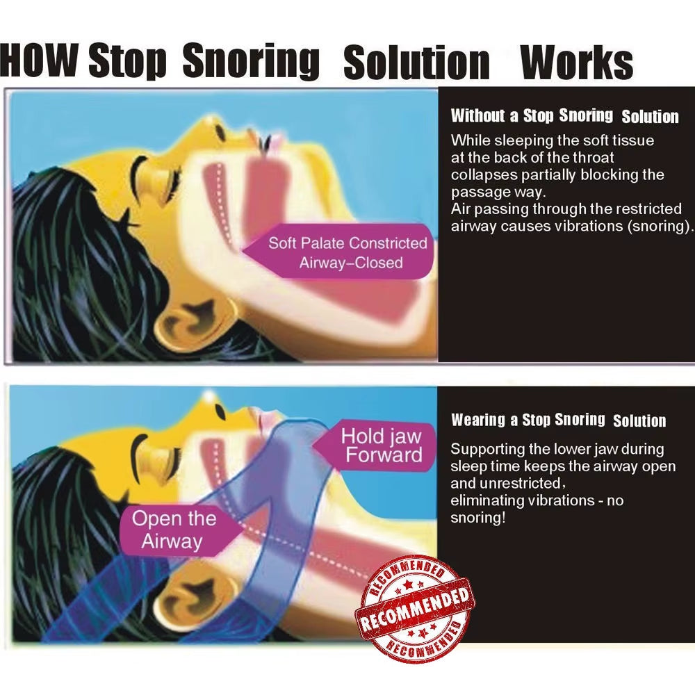 Anti Snore Aid Stop Snoring Strap Sleep Apnea Belt Jaw Solution Chin Support Apnea Belt Snore Stopper Sleep Aids Blue