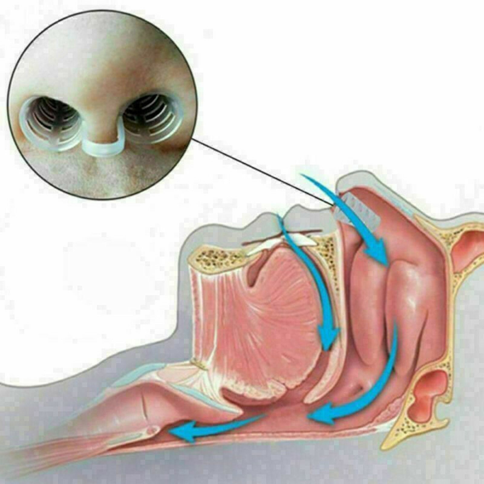 4PCS anti Snore Nose Clip Stop Snoring Stopper Device Sleep Aids Cones Vent